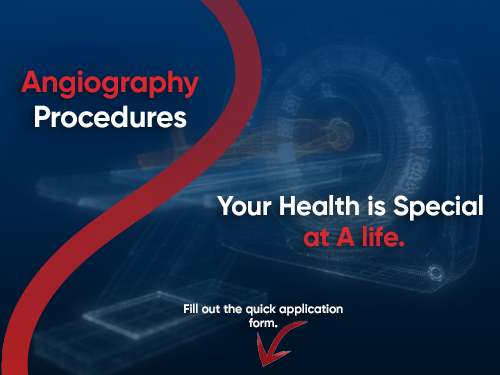 Angioplasty and Stent Placement